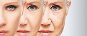 Anti Aging treatments mit Rivoli und Ultraschall